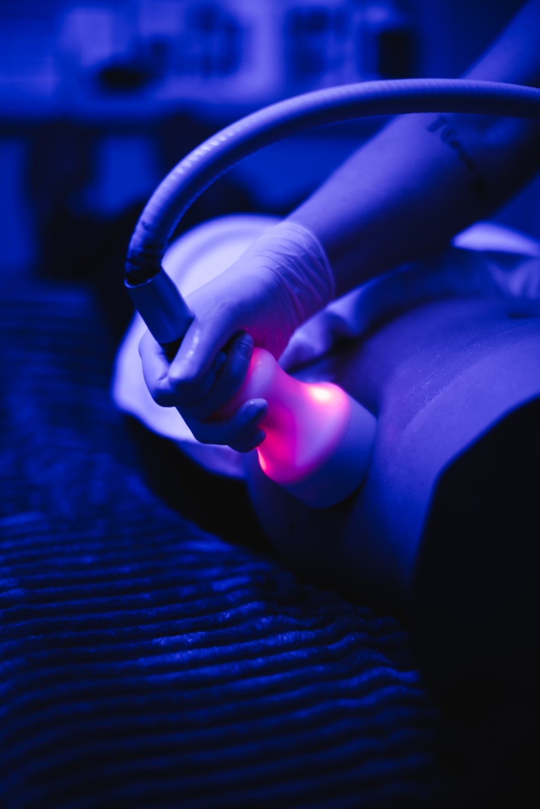 iCRYO Fairfield Cryosculpting body sculpting session